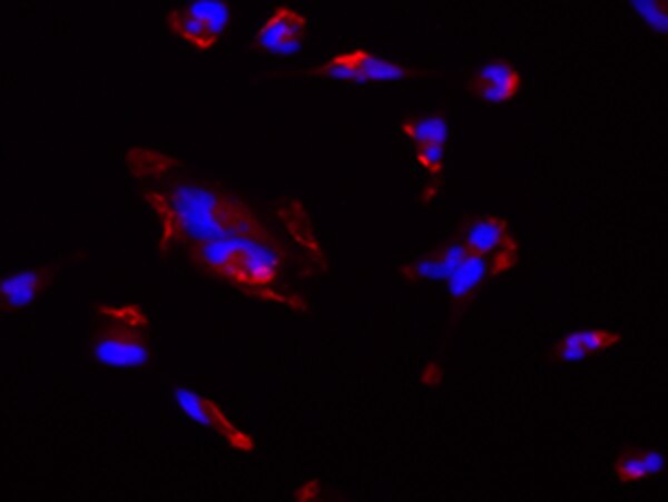 Sk Mel Human Melanoma Cell Line Scc